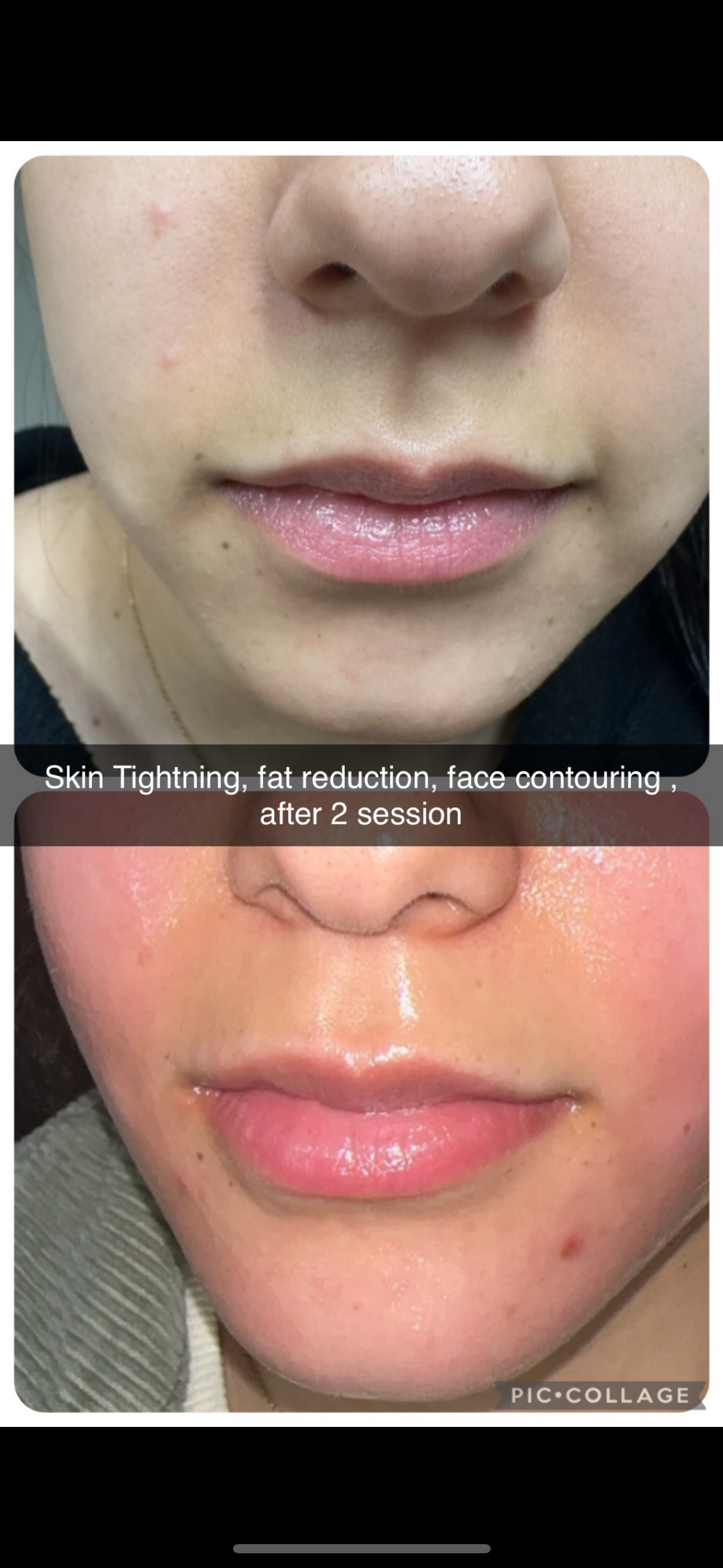 Vivid Laser & Beauty Spa in Farmington Hills
